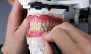 dental lab equipment materials